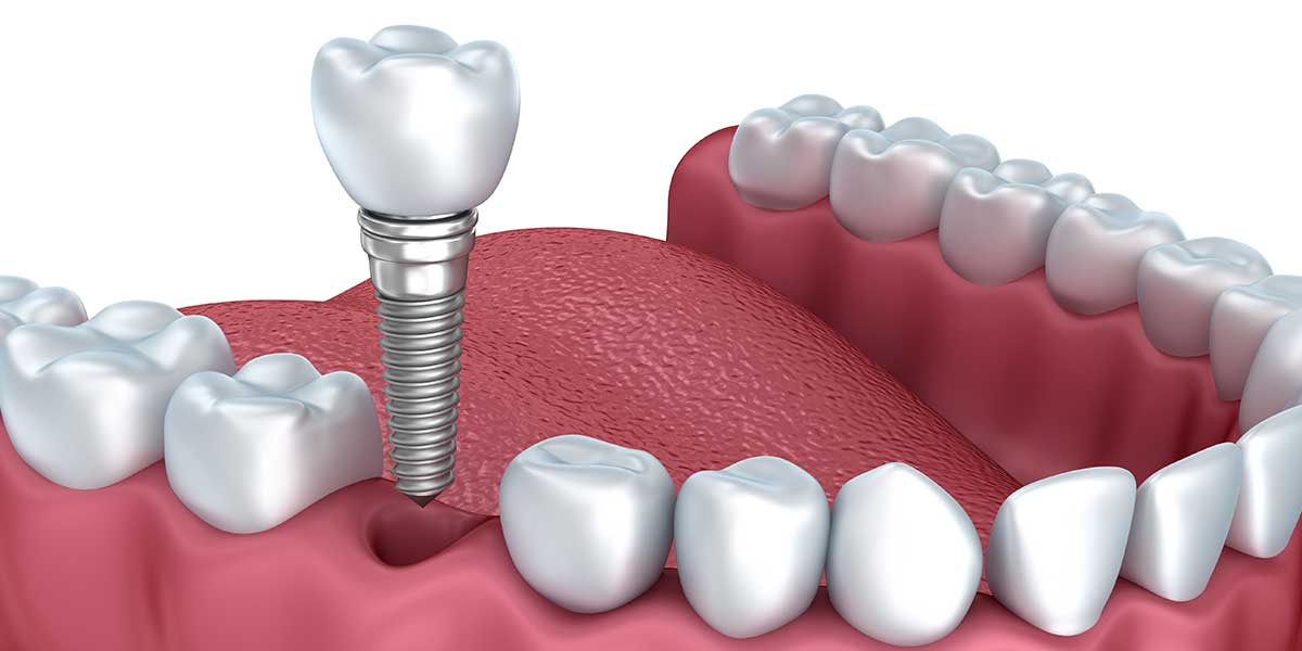 Dentists in Newman