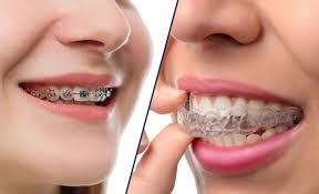 Orthodontics Paraburdoo